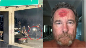 LAPD Shoots Photographer In The Face With Rubber Bullet 2